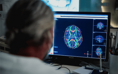SAN CAMILLO IRCCS CERCA: MEDICO NEUROLOGO – RICERCATORE SETTORE NEUROIMMAGINI